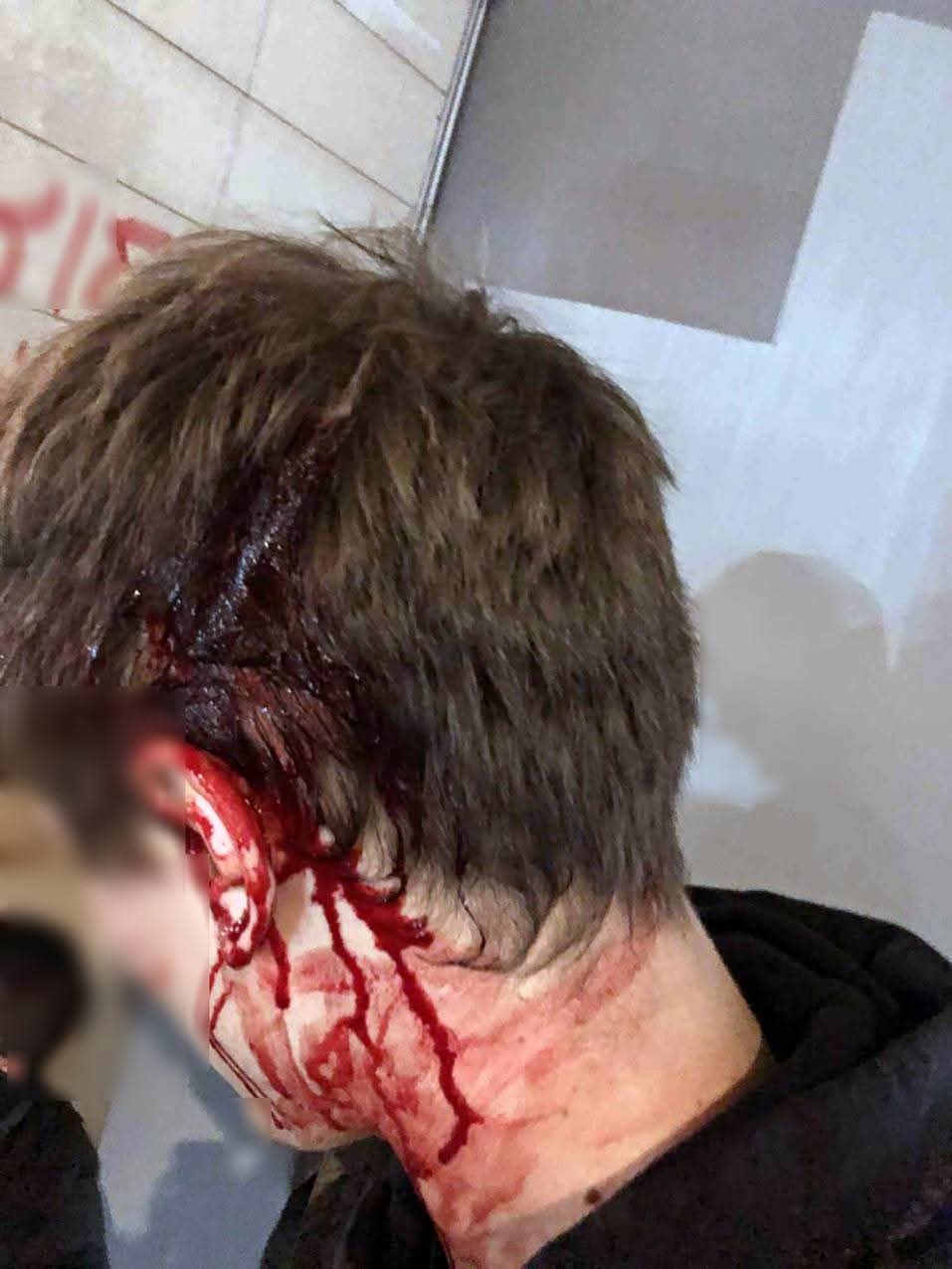 Atene: brutale attacco della polizia alla manifestazione per la Palestina -Liberazione Comunista (Italiano, English)